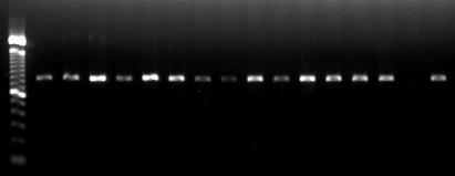 5 Expressão do gene da Internalina A (inla) Os resultados da RT-PCR demonstram que todos os isolados de L.