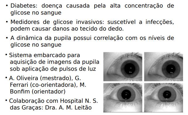 Pupilometria dinâmica