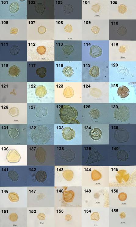Apêndice II Fotomicrografias dos grãos de pólen das plantas coletadas no entorno dos