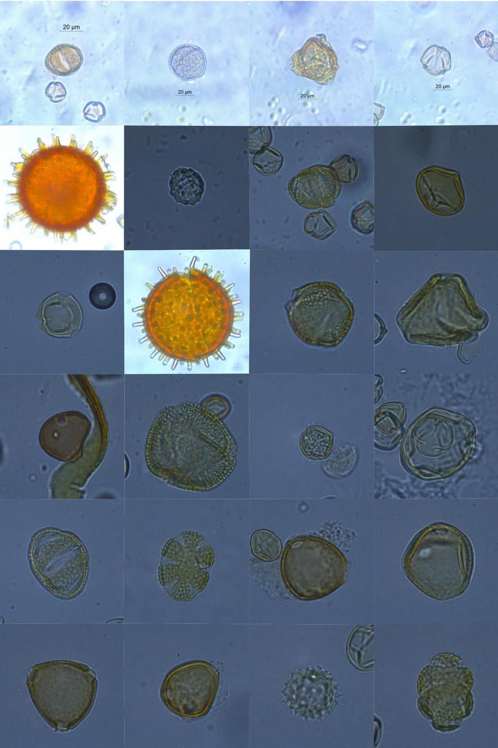 Apêndice III Fotomicrografias dos tipos polínicos encontrados nas amostras