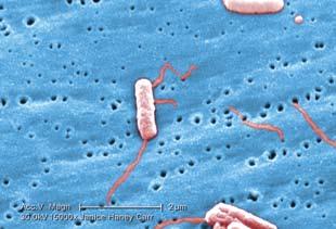 1. INTRODUÇÃO As bactérias do género Legionella encontram-se em ambientes aquáticos naturais e também em sistemas artificiais, como redes de abastecimento/distribuição de água, redes prediais de água