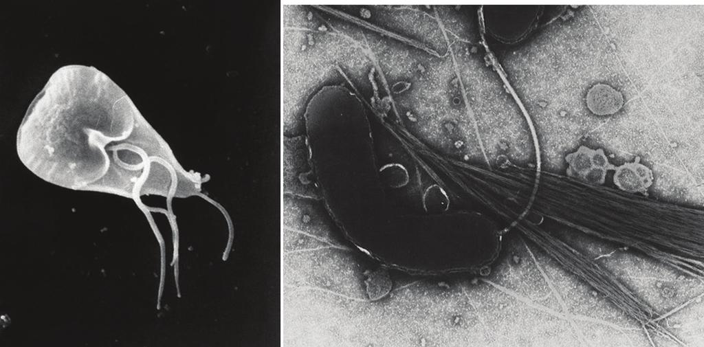 Figura 9: O protista Giardia duodenalis e a bactéria Vibrio cholerae (em forma de grão de feijão, à direita), ambos causadores de diarreias intensas pela irritação da superfície intestinal que não