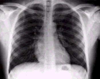 Radiografia do