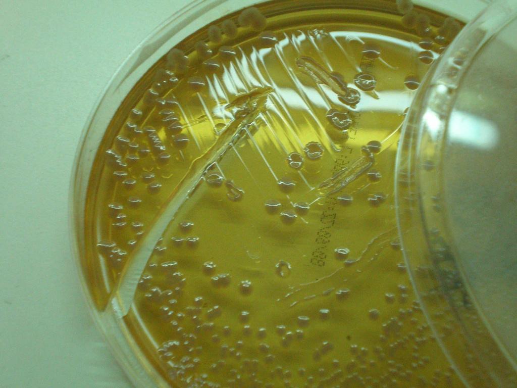 72 TABELA 5 PROVAS DE IDENTIFICAÇÃO BIOQUÍMICA PARA Staphylococcus spp Catalase Motilidade NaCl 5% Oxidase Aeróbio Estrito POS NEG POS NEG NEG FONTE - Detecçcão e Identificação de Bactérias de
