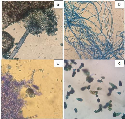 De acordo como exame morfológico realizado através do microscópio nas sementes, foram identificados Aspergillus sp (Figura 3a), Colletotrichum sp (Figura 3b), Penicillium sp (Figura 3c) e Curvulária