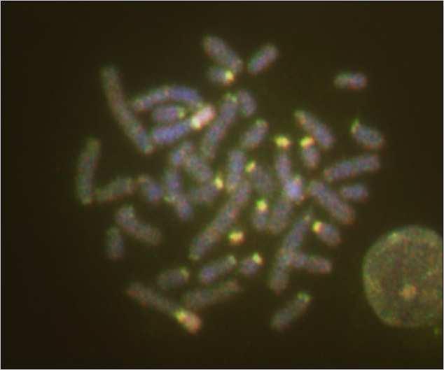 As sondas foram marcadas com digoxigenina e biotina e detectadas com um anticorpo antidigoxigenina acoplado a rodamina (vermelho) e avidina acoplada a FITC (verde), respectivamente.