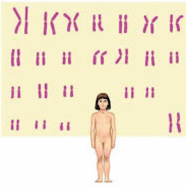 ) 2Nd (Separação dos ) Nd Nd 46 cromossomos paternos (2n) Espermatozóide (n) (23 cromossomos) 46