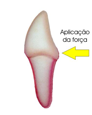 Tipos de movimento: Ancoragem: