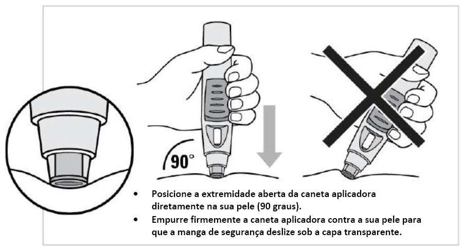 Recomenda-se que a injeção seja realizada sem pinçar a pele (figura à esquerda).