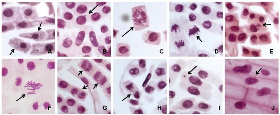 Figura 5 - Alterações nucleares e aberrações cromossômicas em Allium cepa, exposto a diferentes concentrações de Ni. A. Vacuolização do citoplasma - célula em processo de morte celular (seta); B.