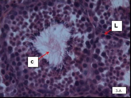 Figura 3- Fotomicrografia de testículo não escrotado, abdominal, de um exemplar adulto