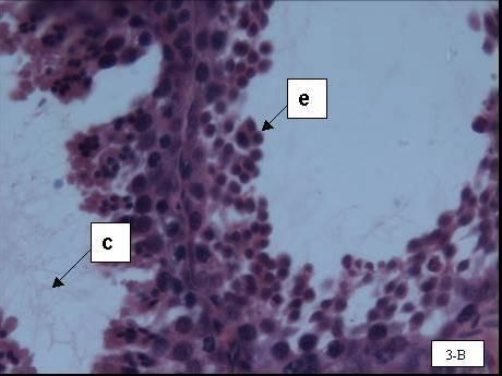 Leydig (L) no tecido intersticial em 3-A; espermatozóides na luz dos túbulos