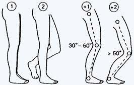 flexão de joelhos entre 30 a 60 + 2 se os joelhos estão flexionados mais 60 (salvo postura sedentária) Carga/Força Carga: Pontuação 0 + 1 movimentos