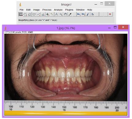 6.5. Medições Executadas Para iniciar as medições, começamos por abrir a imagem que desejamos analisar.