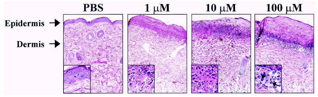 , (2003) HSL (3O-C12-HSL) de Pseudomonas aeruginosa PAO1 induz reações inflamatórias in vivo em camundongos Efeitos de 50µM 3O-C 12 -HSL
