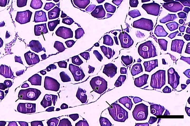 Escala = 100 µm.