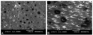 Resultados 79 A D B E C F Figura 12- Fotomicrografias eletrônicas de varredura em 2000X.