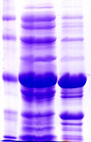 A kda 1 2 3 B kda 1 2 100-75- 100-75- 50- -1 50-35- 35-25- 25- -2-3 Figura 9: Solubilização e clivagem da proteína recombinante - SDS-PAGE 12%. (A) Solubilização da proteína recombinante.