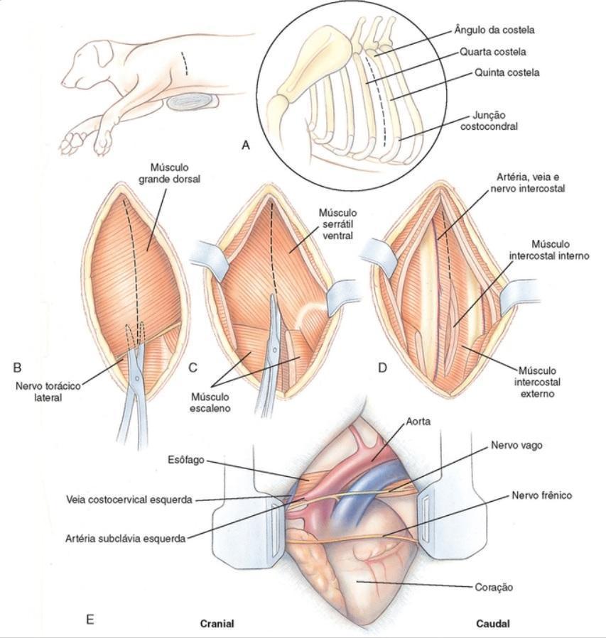 18 Figura 7 Abordagem do esôfago torácico cranial. A) Decúbito lateral direito com uma toalha. B) Músculo grande dorsal (linha pontilhada).
