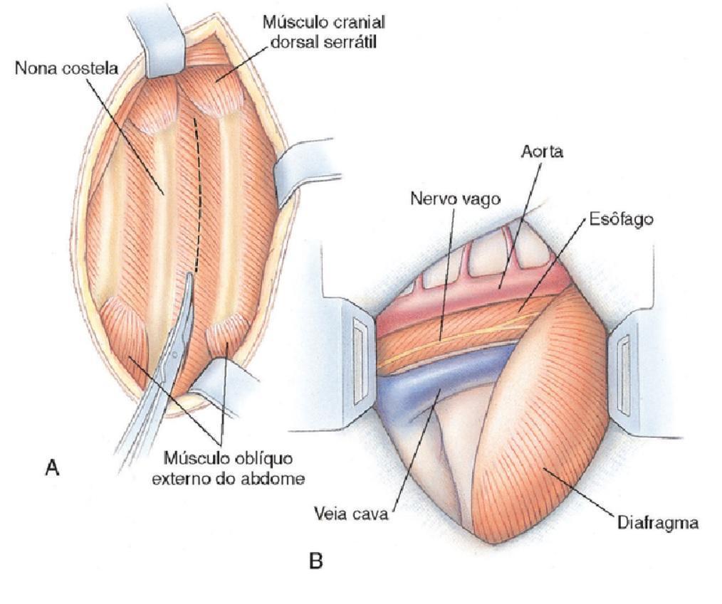 20 Figura 9 Abordagem do esôfago torácico caudal A) Músculos intercostal (linha pontilhada), grande dorsal, serrátil dorsal cranial e abdominais externos oblíquos.