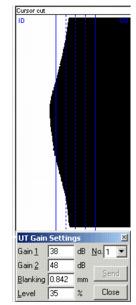 12 de 0 (Out/17) Figura- Imagem apresenta apenas a reflexão da parede interna 14.2.5 Menu Ultrasound A configuração definida através do Setup Wizard e US Gain Settings pode ser checada e, se necessário, modificada através do Menu Ultrasound.