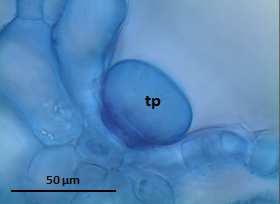 S. S. Sandes et al., Scientia Plena 8, 059902 (2012) 4 Figura 3: Fotomicrografia de corte transversal da folha de patchouli com tricoma peltado. Legenda: tp: tricoma glandular peltado.