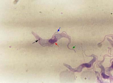 13 Tripomastigota de Trypanosoma cruzi. Seta preta - cinetoplasto; vermelha - núcleo; azul - membrana ondulante; verde - flagelo. (Fonte: http://www.ufrgs.