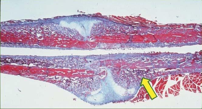 Introdução 20 condrócitos, osteoclastos, osteoblastos, fibroblastos e células endoteliais.