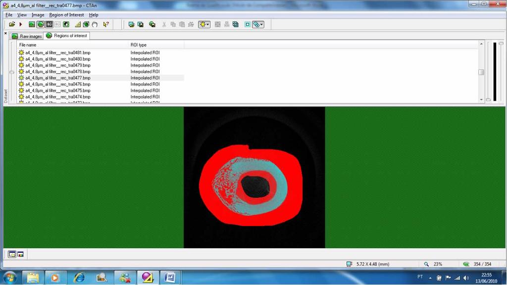 Material e métodos 39 Figura 25 ROI de uma secção transversal da VOI onde há presença do calo ósseo e) Segmentação do tecido de reparo ósseo nas reconstruções microtomográficas de cada fêmur através