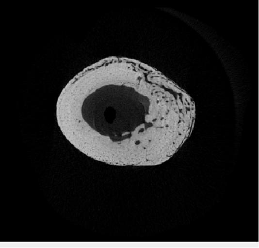 A B Figura 33 Segmentação do tecido de reparo (B) na imagem em tons de cinza (A) da reconstrução microtomográfica transversal de um fêmur (dia 14) A A B Figura 34