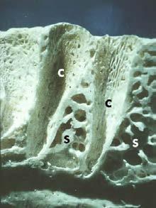 TUDO DEPENDE DO PERIODONTO O MICROAMBIENTE PERIODONTAL OSSO ALVEOLAR (OA) - OA de Inserção e Medular; - Alto turnover; osteoclastos