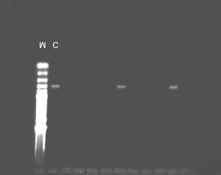 Resultados 54 386 pb Figura 2 : Gel de agarose a 2% mostrando, da esquerda para a direita, o marcador (M) de peso molecular (100