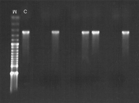 Resultados 55 316 pb Figura 4: Gel de agarose a 2% mostrando, da esquerda para a direita, o marcador (M) de peso molecular