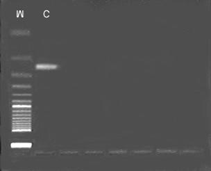Resultados 56 123 pb Figura 6: Eletroforese em gel de agarose a 3%, mostrando, da esquerda para a direita, o marcador (M) de peso molecular (50 bp DNA Ladder), o controle positivo (C) para o M