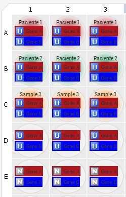 3. Selecione os poços A1, A2 e A3 e atribua a amostra assign Paciente 1. Repita para outros poços/outras amostras. É possível alterar o zoom da placa detalhe (Fig. 7).