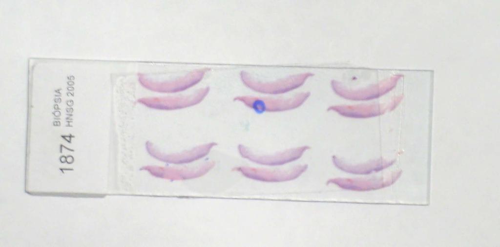 46 tabuladas. Após a confecção do bloco-receptor, foram feitas lâminas histológicas para a realização das provas imunohistoquímicas.