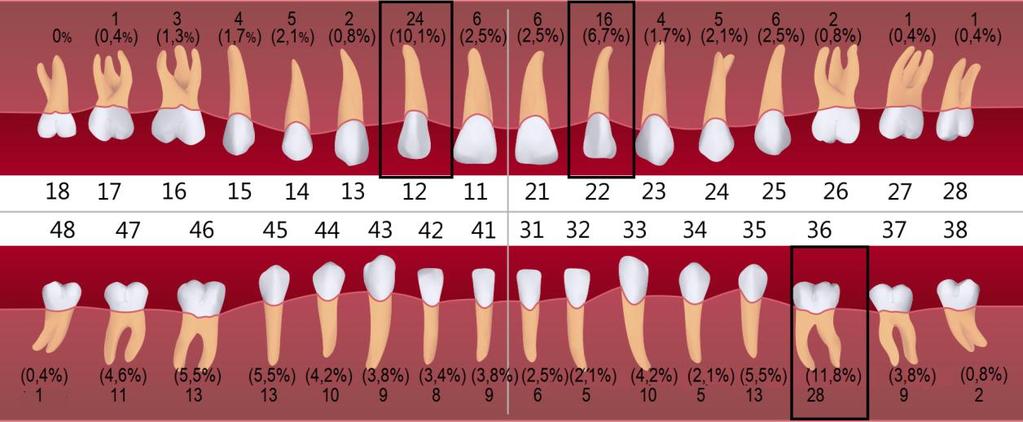 16 Figura 1. Distribuição das alterações apicais de acordo com o dente acometido. Fonte: Dados da pesquisa, Araruna/PB, 2016.