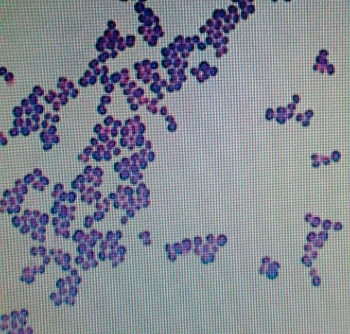 Presença de turvação do meio nos 24 tubos que sofreram contaminação com Enteroccoccus faecalis. (B). Figura 3. Presença de cocos no microscópico, confirmação da contaminação por Enterococcus faecalis.