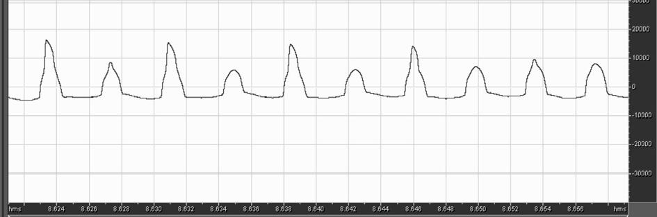 As ondas filtradas foram inspecionadas manualmente, uma a uma, com o objetivo de se identificar traçados irregulares que poderiam comprometer a análise automática feita posteriormente.