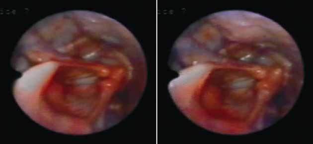 Epiglote Pregas Vocais Faringe Figura 17 Imagens representativas dos ajustes laríngeos para o movimento melódico do trecho 01 (sujeito CT3).