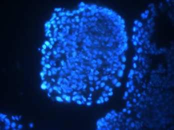 Capítulo 3. Resultados Experimentais e Discussão 52 Neste trabalho, foram utilizadas imagens de células tronco pluripotentes cultivadas in vitro.