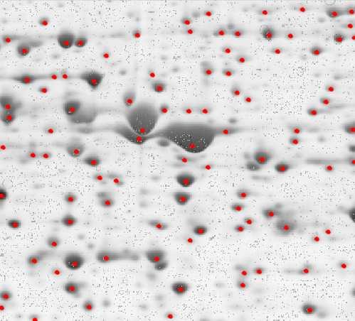 2 mostra os resultados obtidos para imagens bidimensionais de electrophoresis gels. Nestas imagens o objetivo é encontrar os spots, os quais representam proteínas.