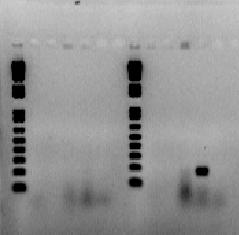 Os resultados referentes aos testes A e B são similares, sendo que os produtos de amplificação de 187pb foram observados em amostras de SP, quando da utilização do Mix SP.