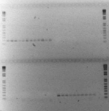 31 Em relação ao teste D apresentado na Figura 11, observa-se que as amostras de SG apresentaram produto de amplificação de 187pb em reações com reverse primer SG-específico e as amostras de SP em
