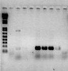 34 5.1.2.2. DNA obtido pelo método de extração de DNA a partir da colônia bacteriana segundo SAMBROOK & RUSSEL (2001) e TURNER et al.