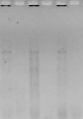 41 A eletroforese da amostra 21 de S. Gallinarum, a qual apresenta reação bioquímica atípica e demais amostras de SG, as quais apresentam reação bioquímica típica (Fig.22).