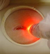 Figura 3: Fotobiomodulação laser (LOUZADA, 2008) Figura 4: Iluminação