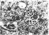 Slide 27 Agente etiológico Ordem: Nidovirales SH1 Família: Arteriviridae Tendência a mutar rapidamente; Provoca imunossupressão.