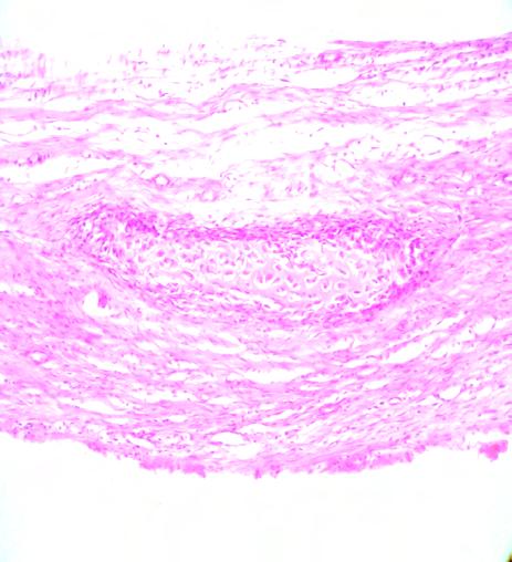 Visão panorâmica da região do defeito evidenciando tecido ósseo mais maduro