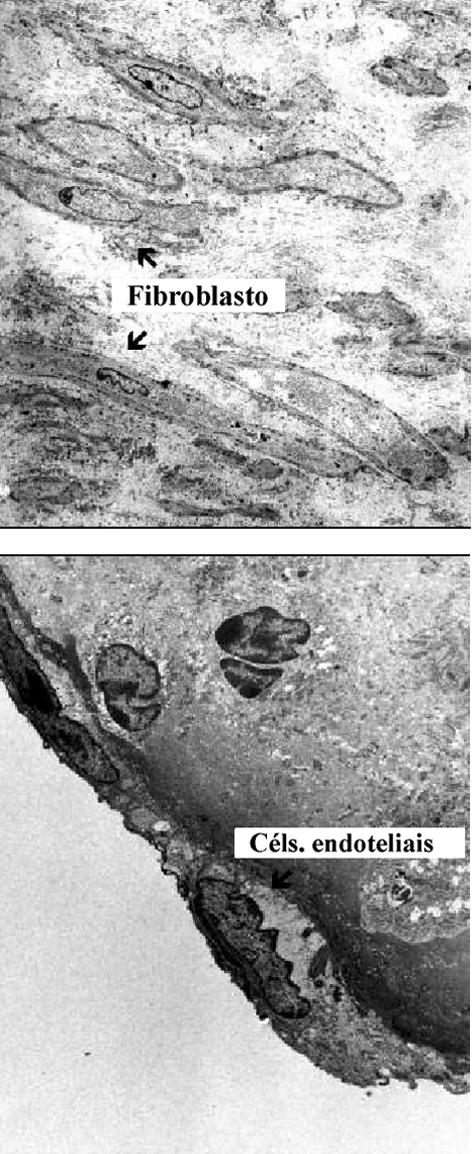 Microscopia eletrônica de transmissão - Células endoteliformes foram visíveis na superfície interna das valvas obtidas por engenharia de tecidos examinadas aos sete dias, três e seis meses.